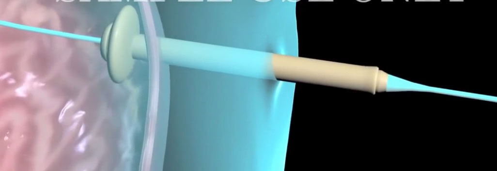 Esquema de la sonda de alimentación